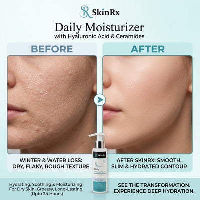 Moisturising Lotion 120ml